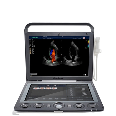 Portable 3D 4D Color Doppler USG&Sonoscape S9