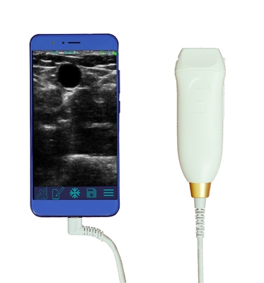 Hot Sale Smart USB Convex Medical Doppler Ultrasound Scanner Ultrasound Probe