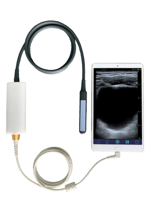 Hot Sale Smart USB Convex Medical Doppler Ultrasound Scanner Ultrasound Probe