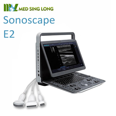 SonoScape E2pro Color Doppler Echo Machine Ultrasound Machine USG with TDI CW PW Function
