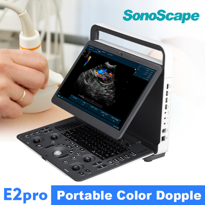 SonoScape E2pro Color Doppler Echo Machine Ultrasound Machine USG with TDI CW PW Function