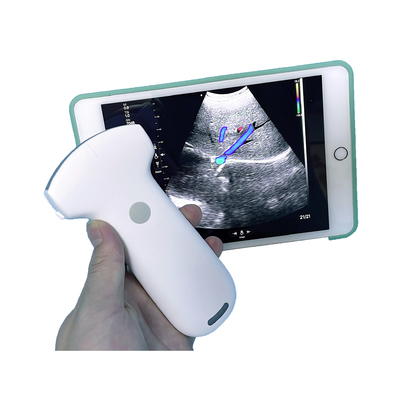 Medical 192 Element Wireless Handheld Color Doppler Ultrasound Probe Built-in Lithium Battery