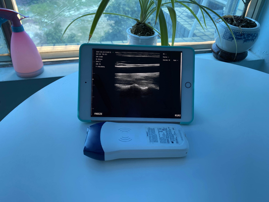 Medical 128 Element Wireless Handheld Color Doppler Linear Ultrasound Probe Built-in Lithium Battery