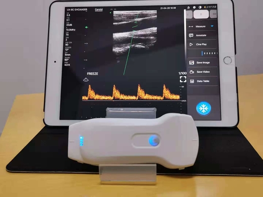 5D HD Live Ultrasound Probe for Sale