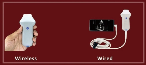 Wifi Cardiac Transducer Portable Echocardiography Probe Medical Ultrasound Scanner Price