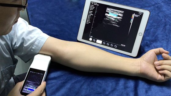 Wireless Linear Array Ultrasound Probe Handheld Wifi Ultrasound Scanner Price for Sale