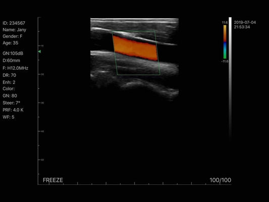 Wireless Linear Array Ultrasound Probe Handheld Wifi Ultrasound Scanner Price for Sale