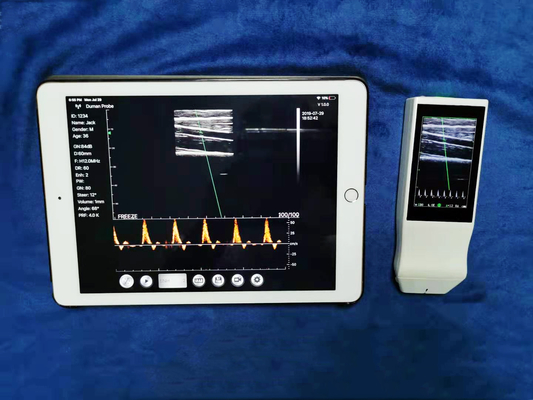 Wireless Linear Probe High Frequency Probe Special Tool for Visual Puncture Guidance Integrated Handheld Ultrasound Scanner