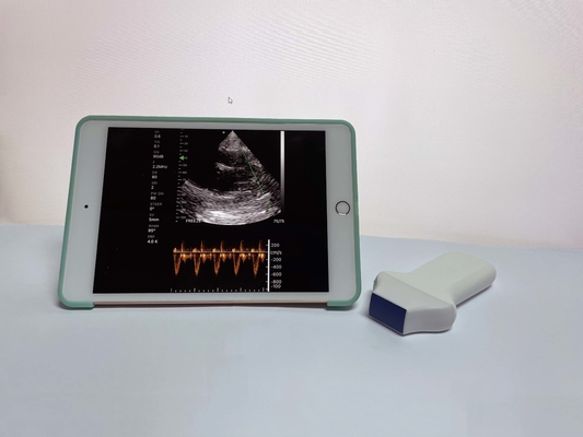 Portable Hand Held Used Cheap Phased Array Ultrasound Machine Probe