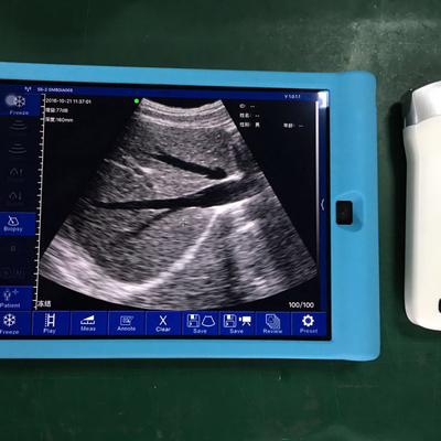 High Quality Medical Ultrasound  Handheld Wireless Mini Color Doppler Ultrasound Scanner