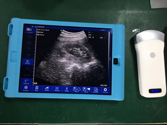 High Quality Medical Ultrasound  Handheld Wireless Mini Color Doppler Ultrasound Scanner