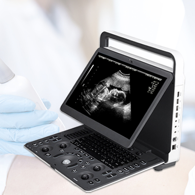 E2V Veterinary Ultrasound Doppler Color Sonoscape E2