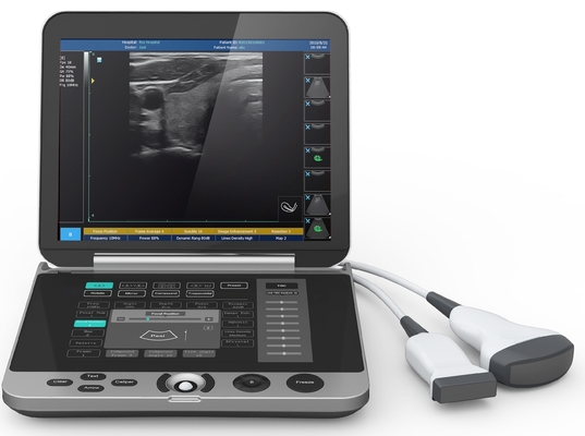 High Resolution  Laptop B/W Ultrasound MSK  Ultrasound Scanner  Laptop Ultrasound Machine