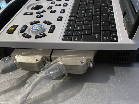 Digital Human Veterinary Portable Ultrasound Machine Ultrasound Portable Ultrasound